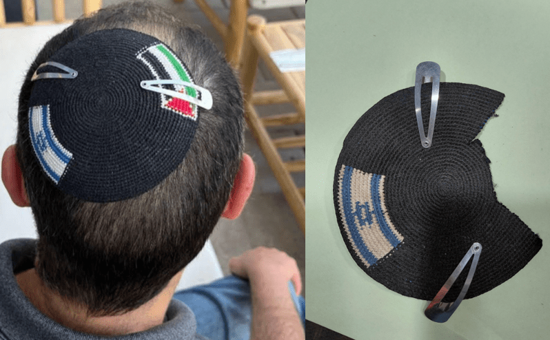 Alex Sinclairs kippa med Israels och Palestinas flaggor före polisens ingripande och efter att den palestinska flaggan klippts bort.